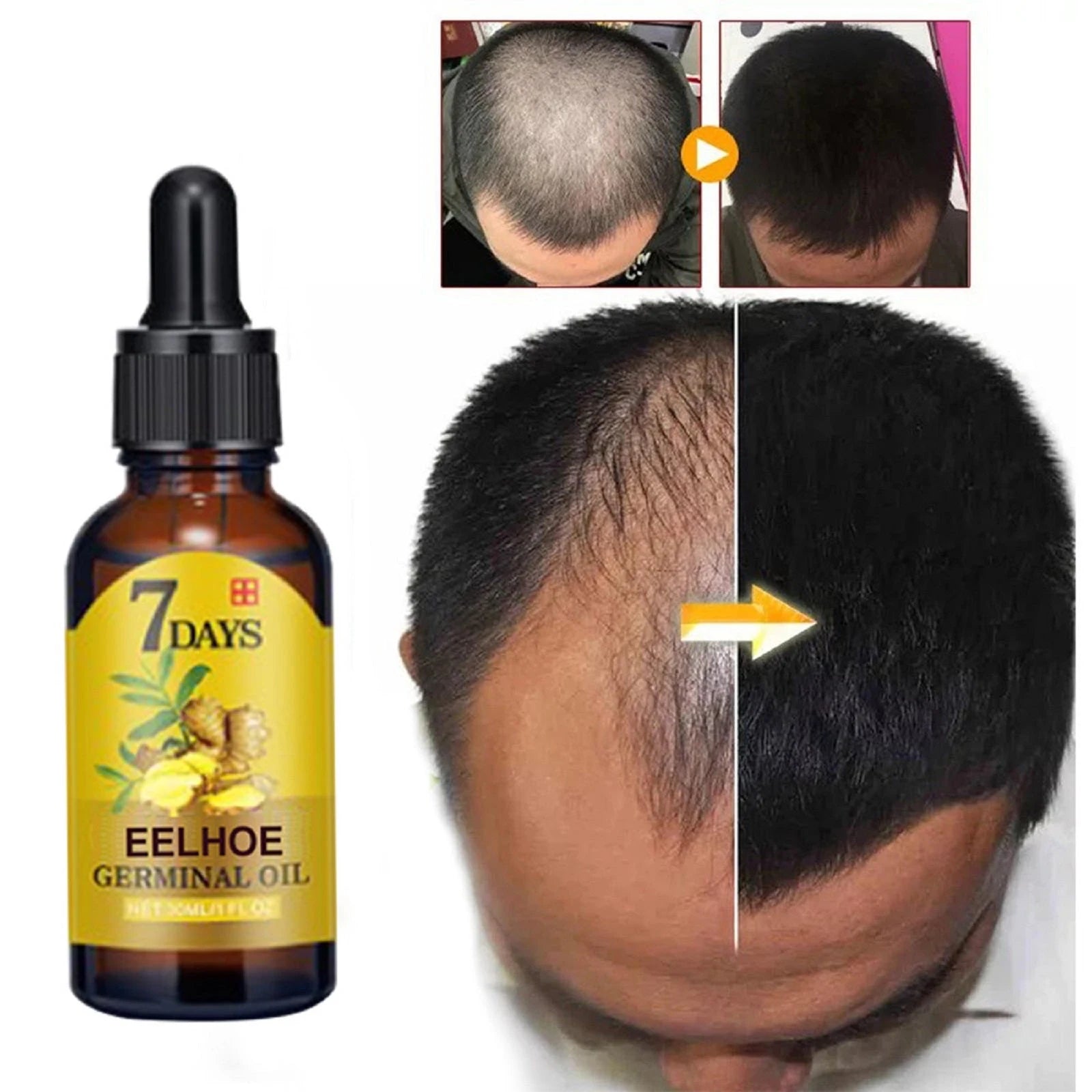 Fast Ginger Hair Growth Serum 40ml