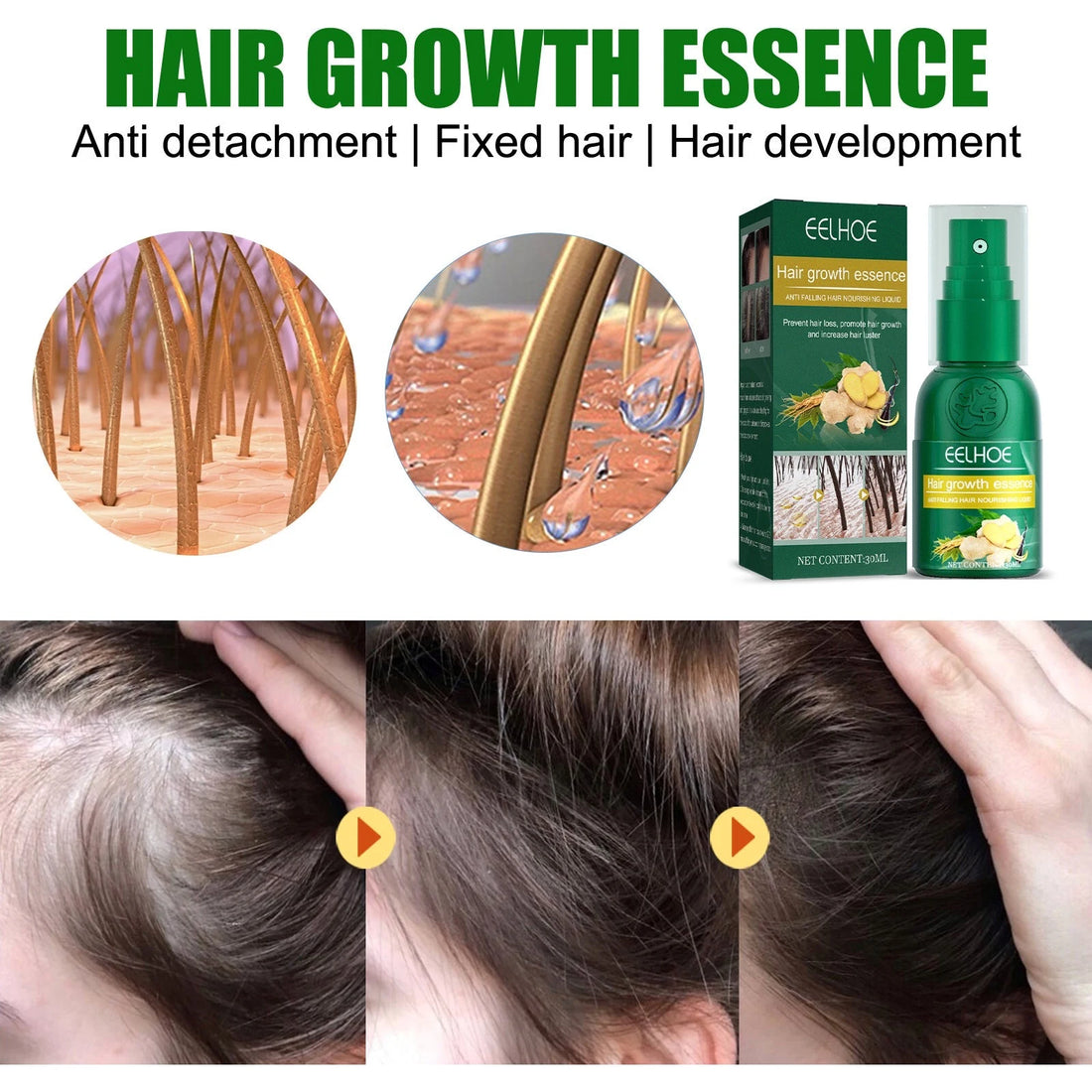Ginger Hair Growth Spray for Thinning Hair Care
