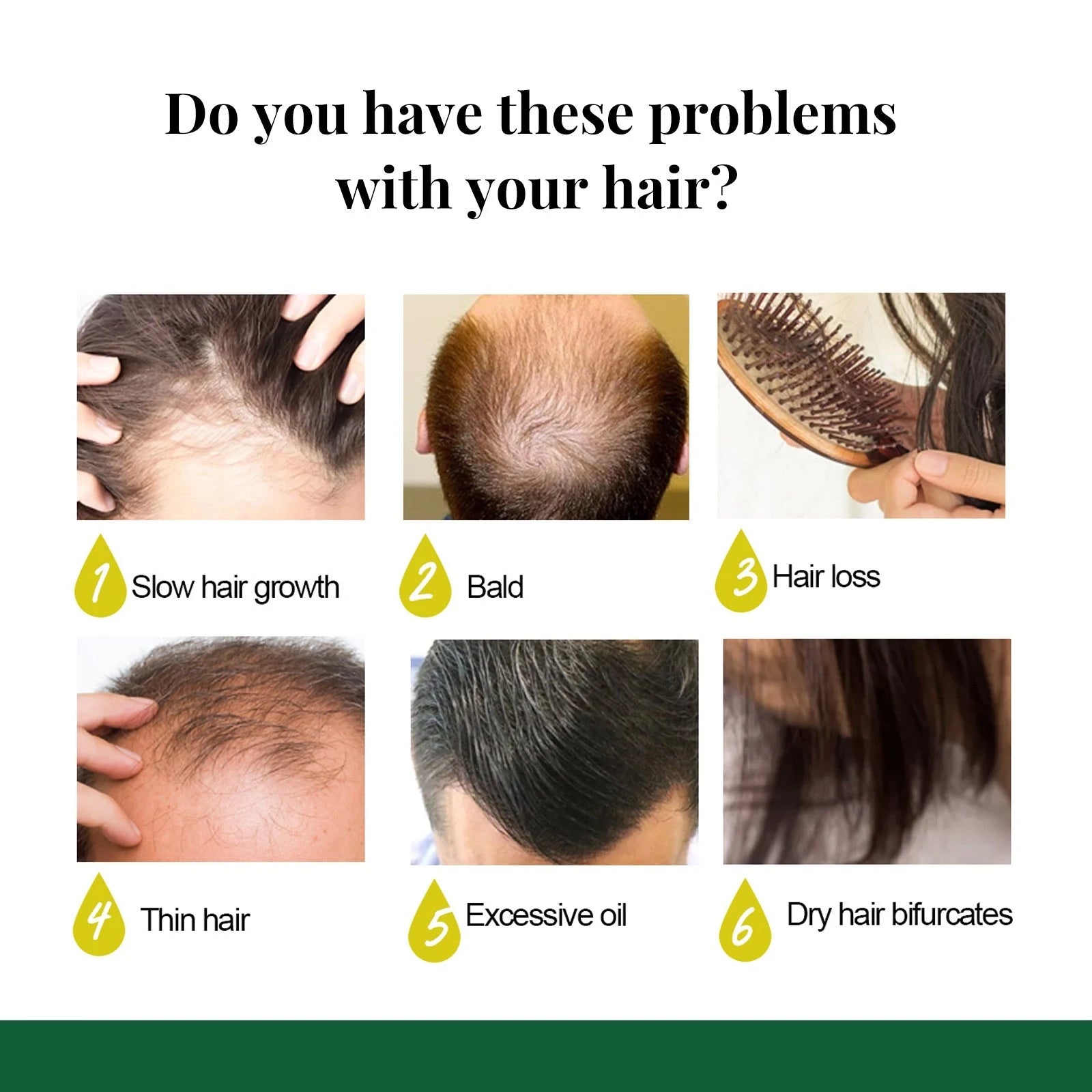 Fast Ginger Hair Growth Spray for Thinning Hair