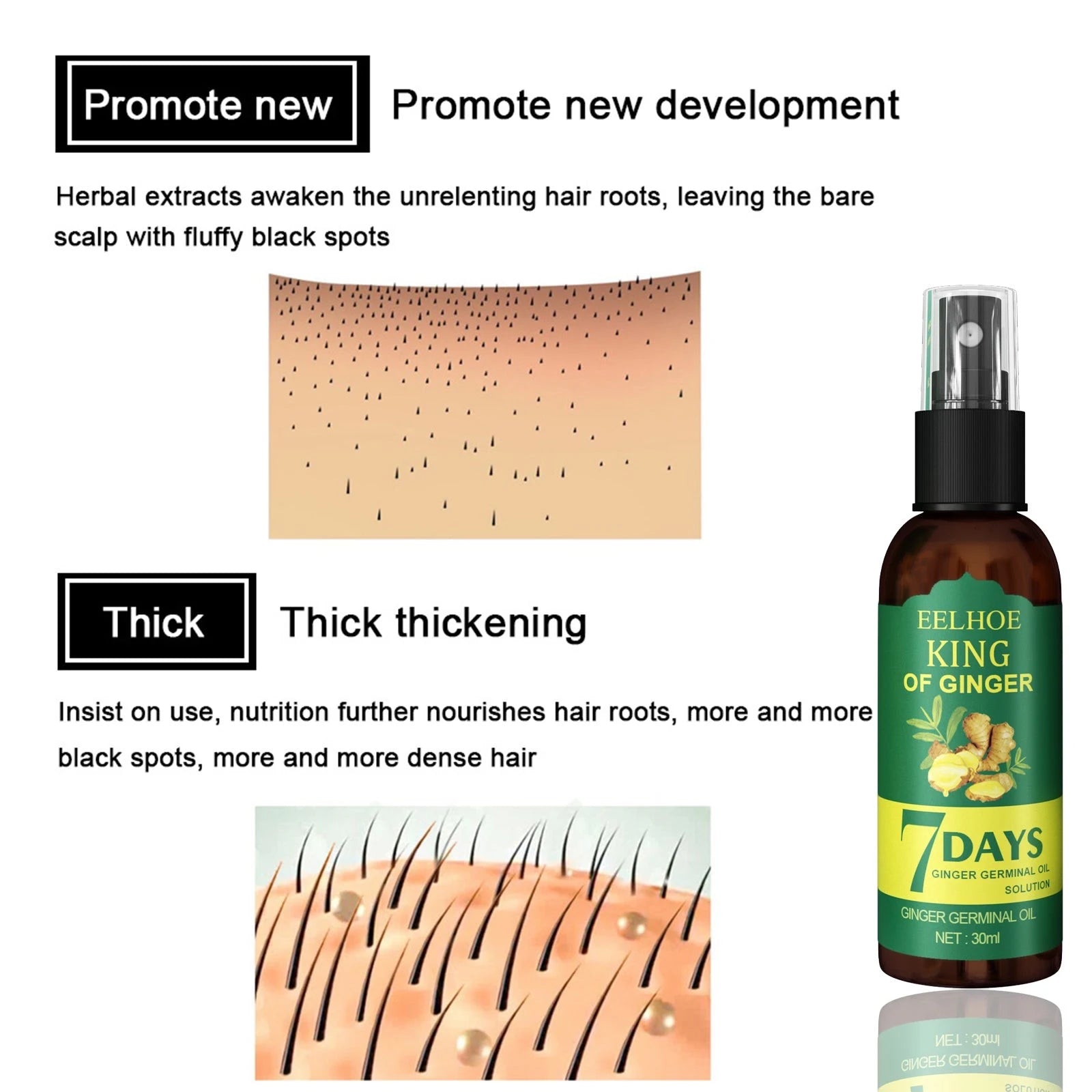 Fast Ginger Hair Growth Spray for Thinning Hair