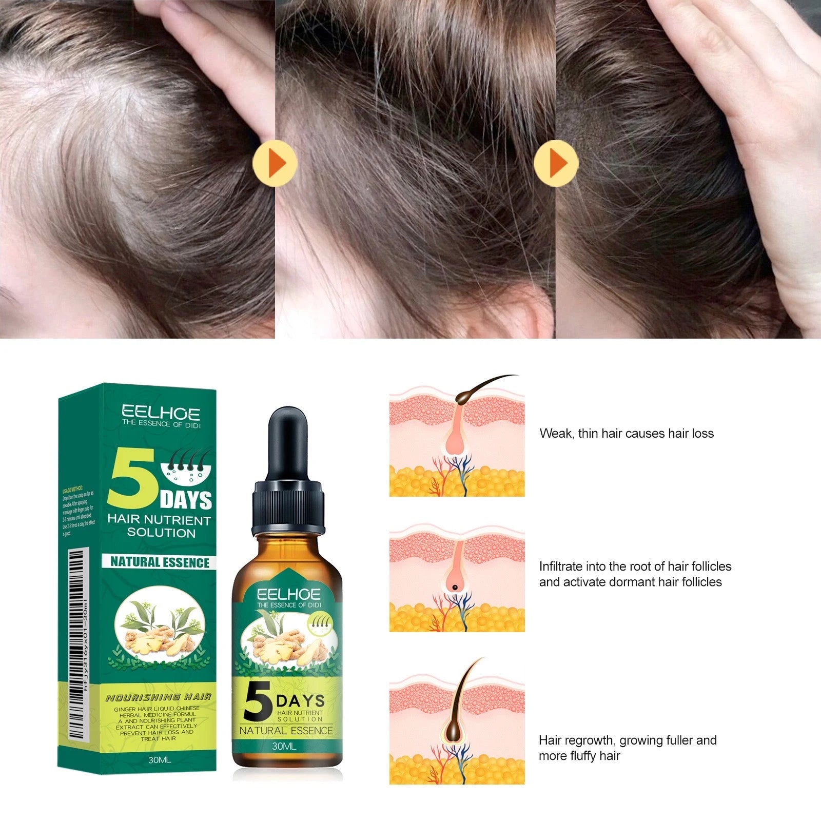 5 Days Ginger Hair Growth Oil for Thinning Hair