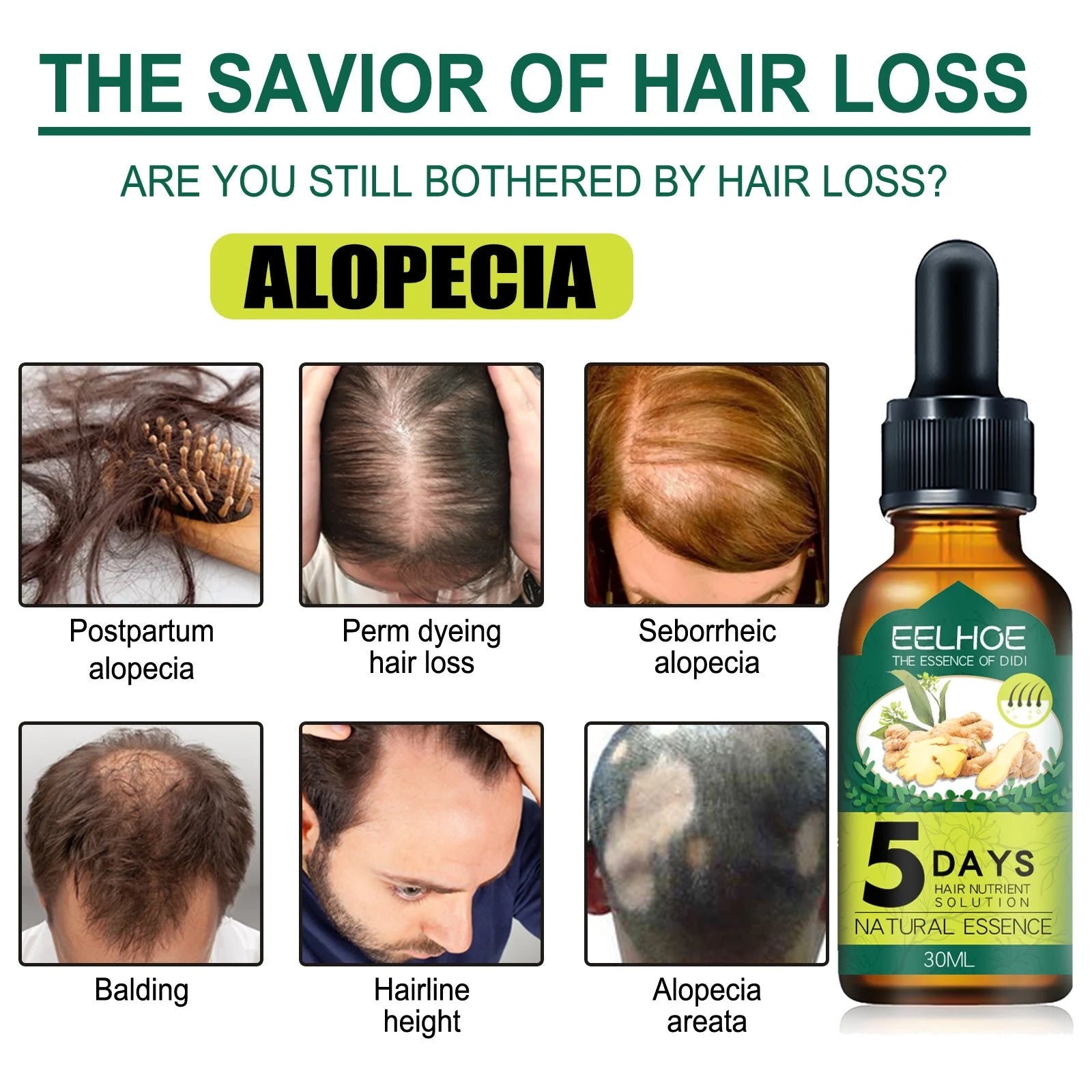 5 Days Ginger Hair Growth Oil for Thinning Hair