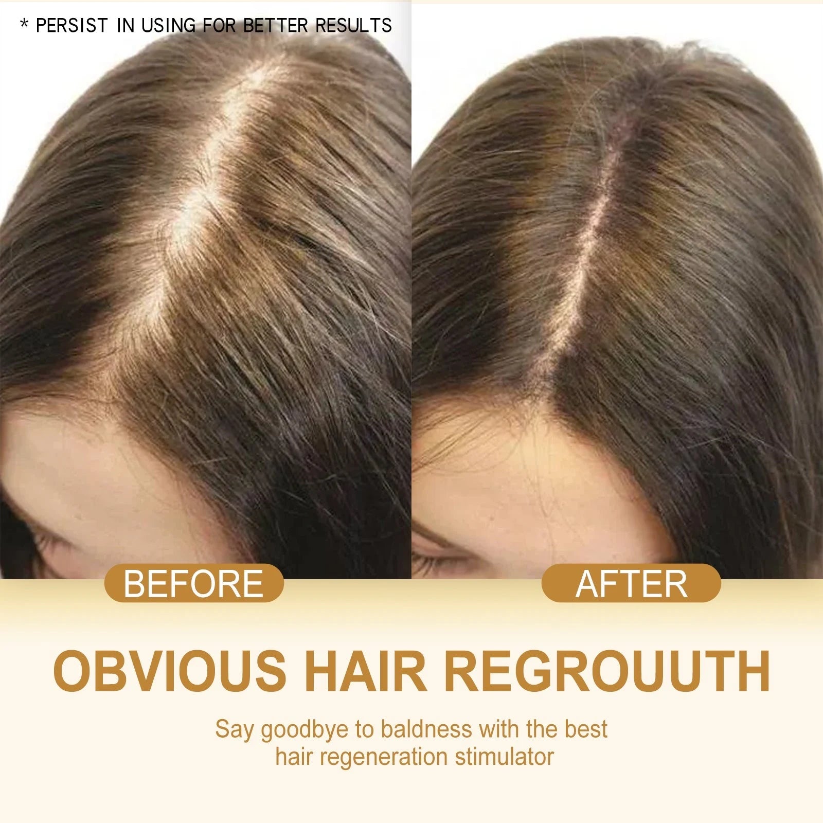 Ginger Scalp Care Shampoo for Thinning Hair
