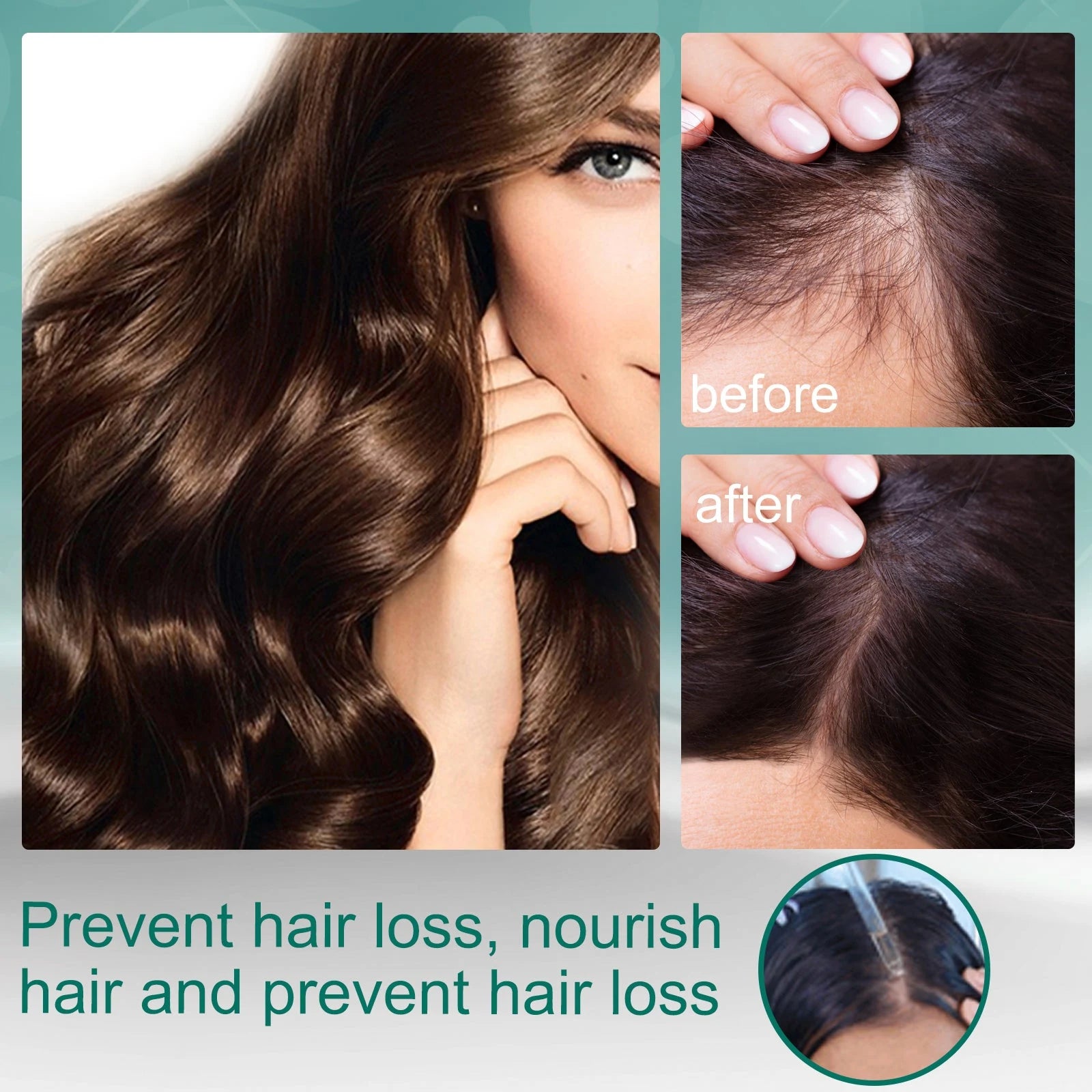 Ginger Scalp Serum for Dry Scalp