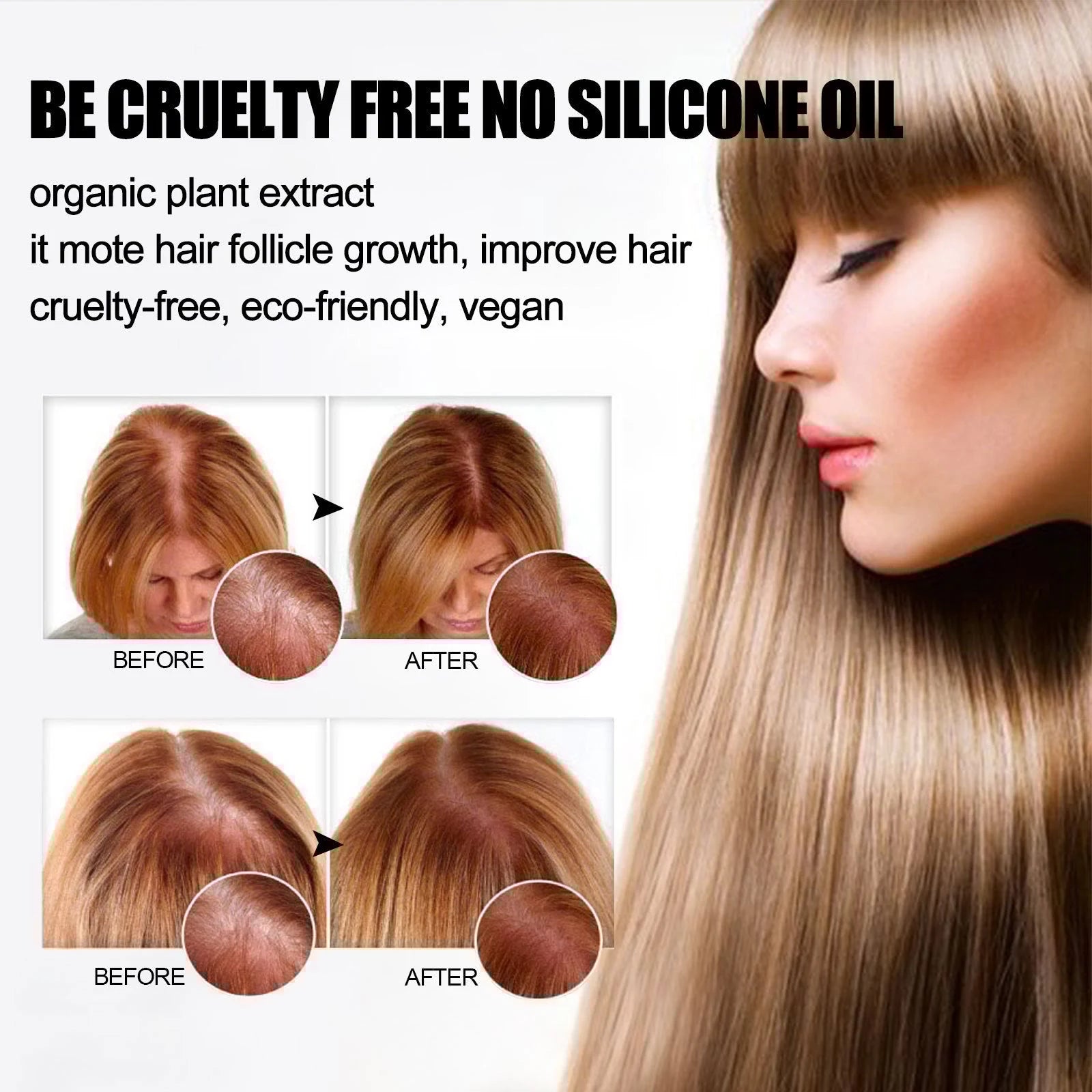 Ginger Anti Hair Loss Shampoo for Thinning Hair