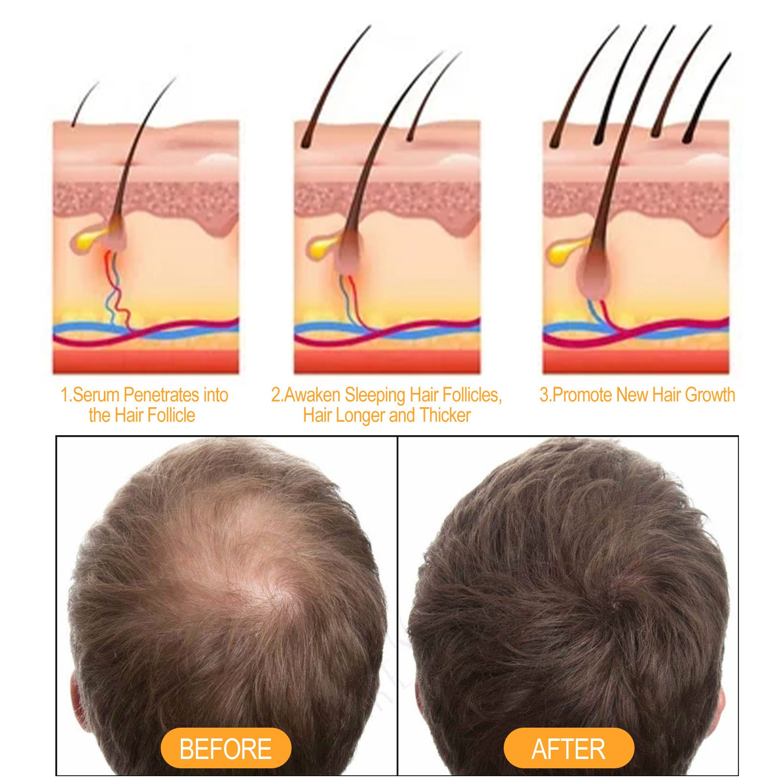 Ginger Hair Growth Shampoo for Thinning Hair